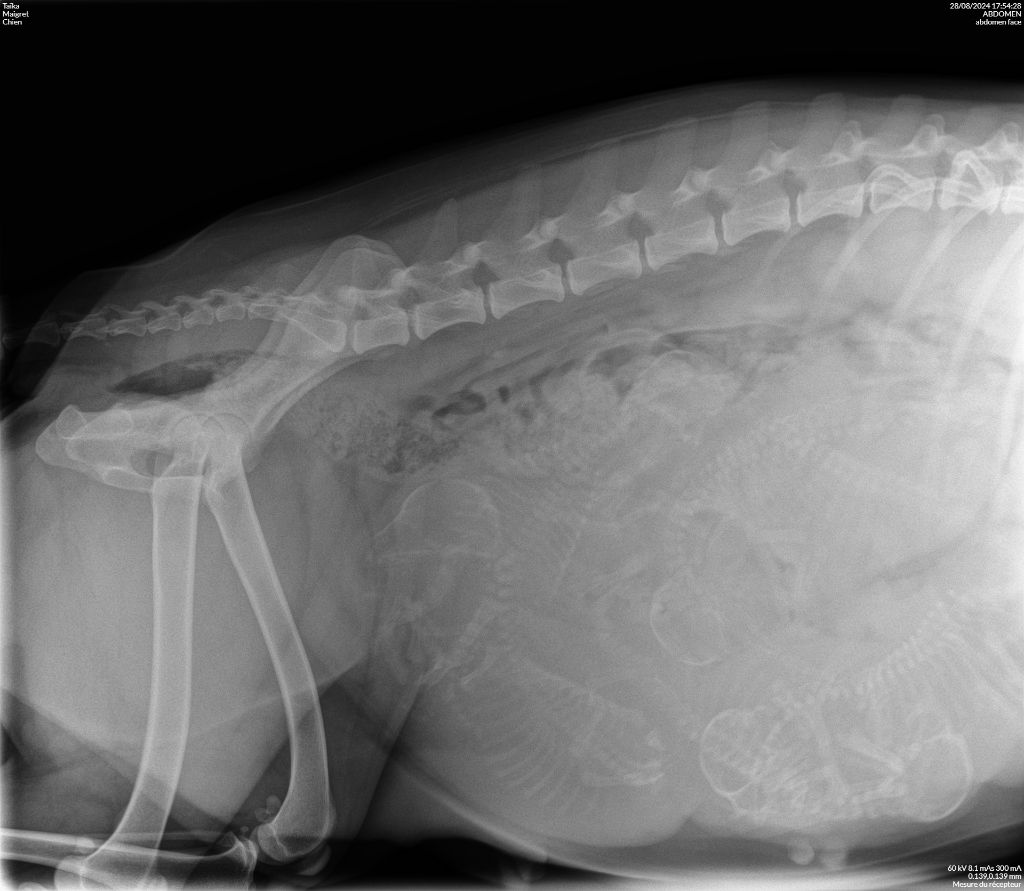 Radiographie de gestation